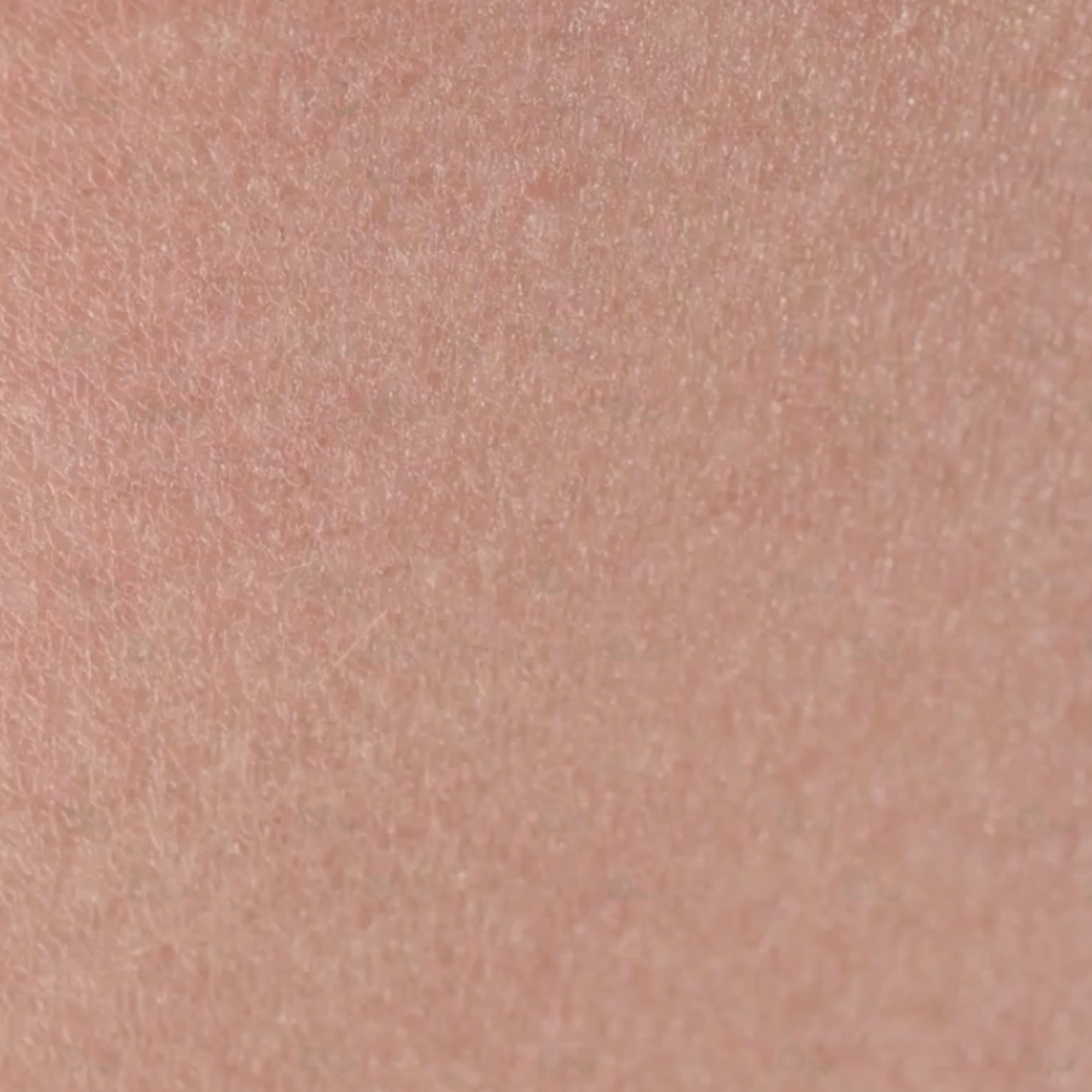 Dry skin 
